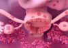endometrios